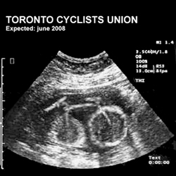Toronto Cyclists Union Ultrasound